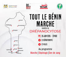 Lutte contre la drépanocytose : une grande campagne de dépistage gratuit annoncée dans les 12 départements